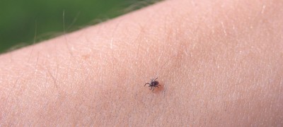 Ways to remove a tick at home