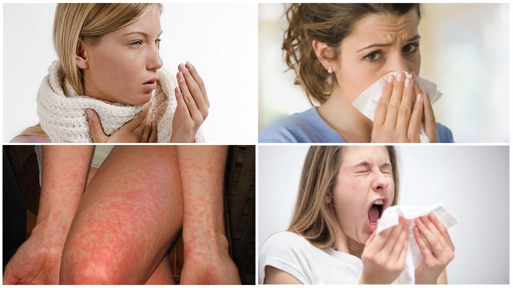 linen mite allergy