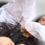 how to remove gum from hair with a napkin