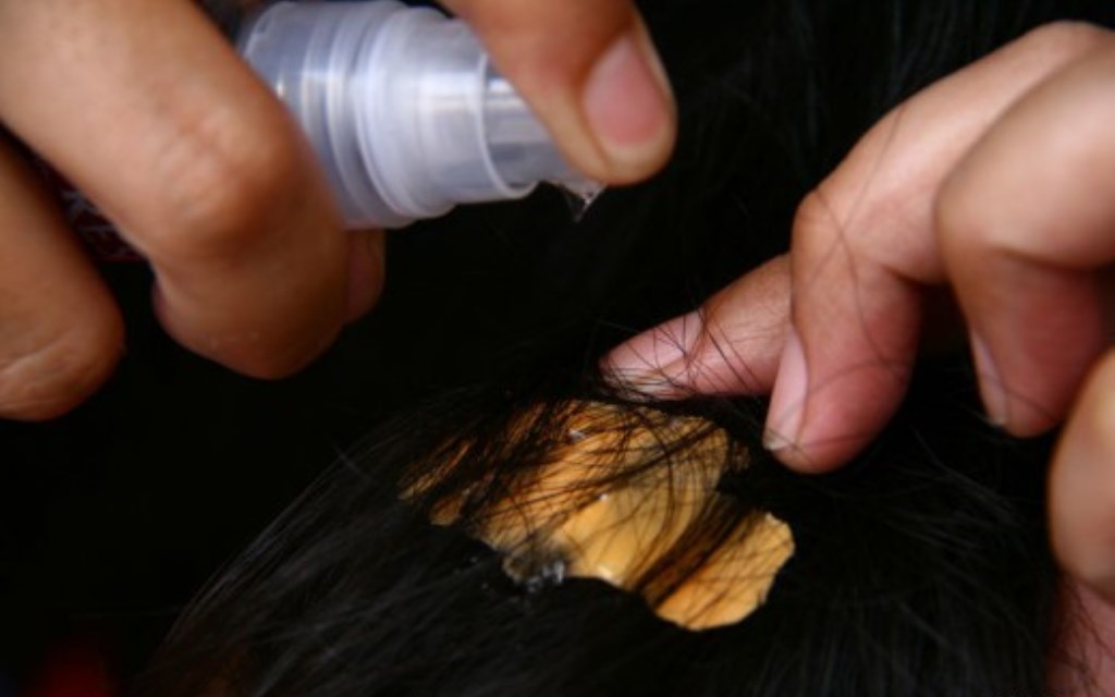 how to remove gum from hair with silicone drops