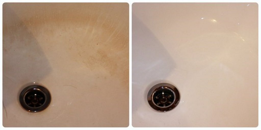 plaque removal before and after